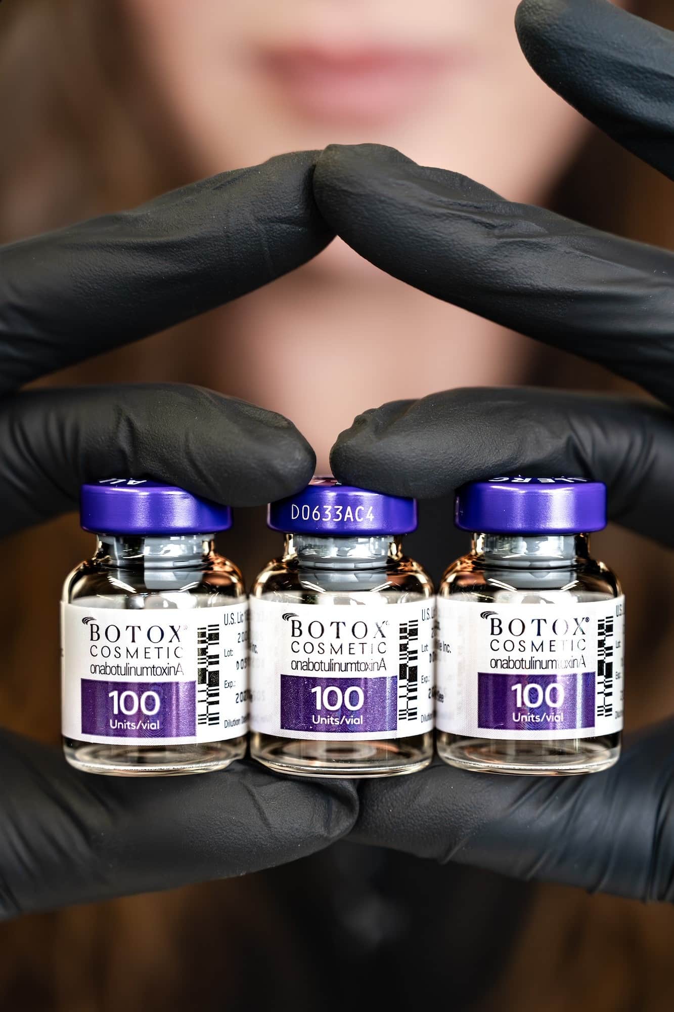 Botox injection treatment at SG Aesthetics & Wellness in Charleston, SC