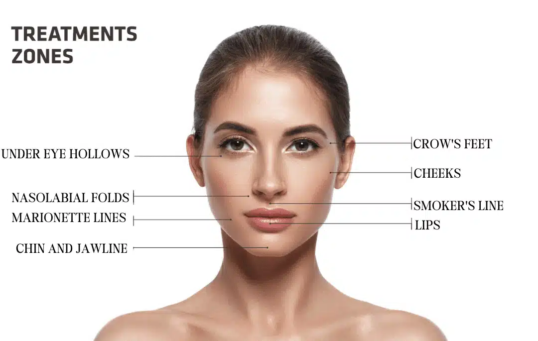 Insta-Grid-Posts-8.5-x-5.5-Flyer-Instagram-Post-9-e1715819583817.png - SG Aesthetics & Wellness