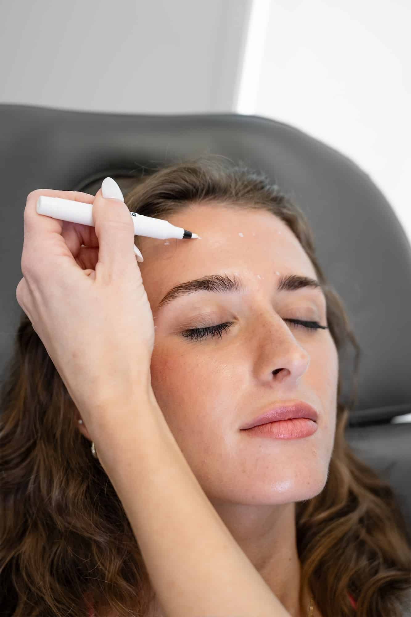 Skinvive in Charleston SC at SG Aesthetics & Wellness - SG Aesthetics & Wellness Skinvive in Charleston SC at SG Aesthetics & Wellness