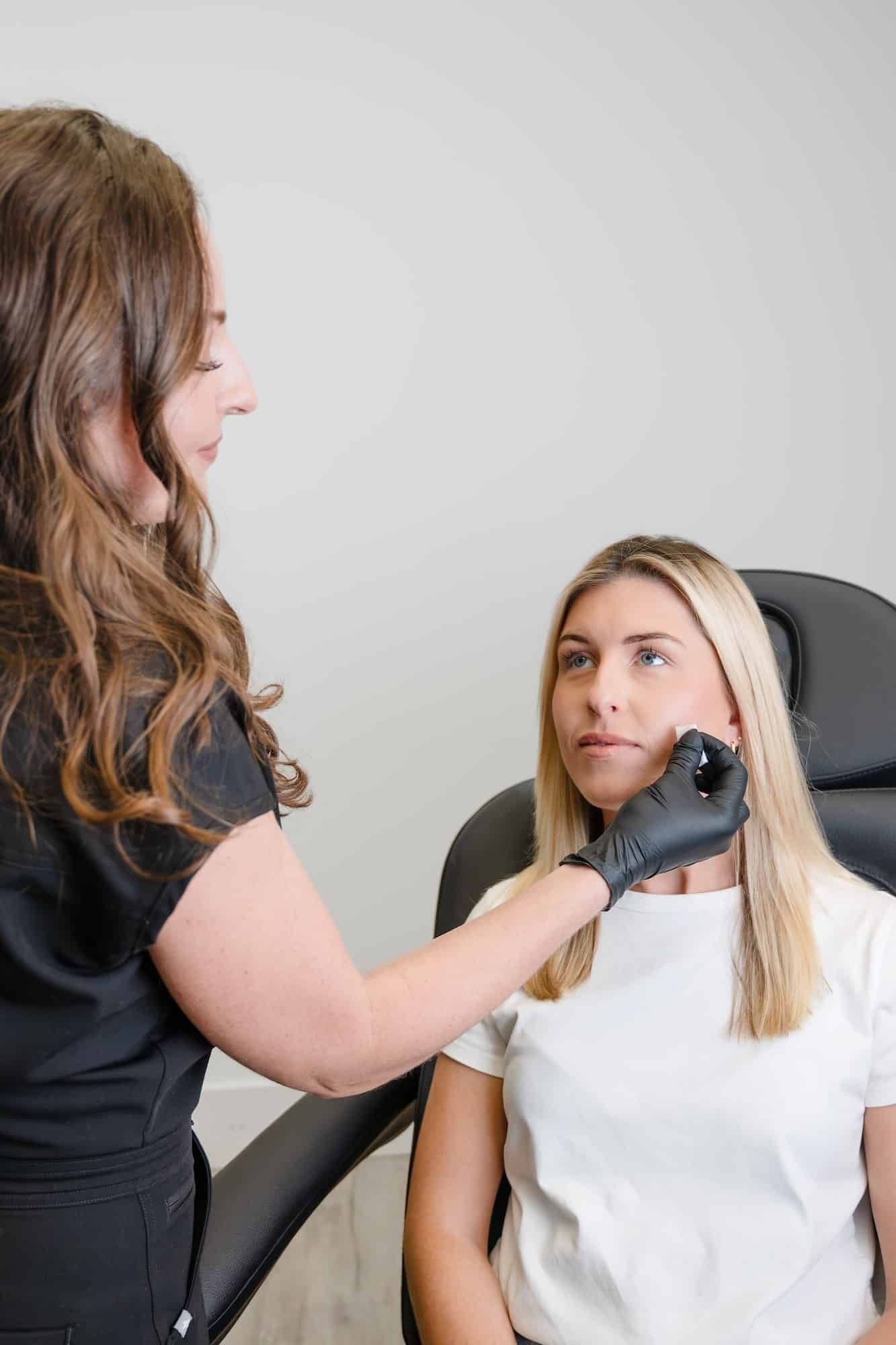Redness, Rosacea & Veins treatment in Charleston reducing facial redness and visible veins with advanced laser technology