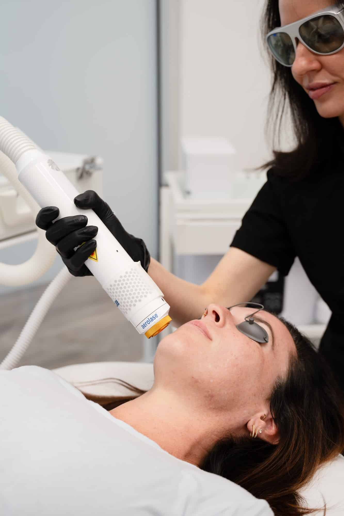 Close-up of laser device treating facial redness to improve overall skin appearance
